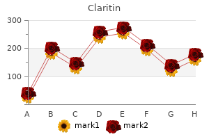 cheap 10mg claritin fast delivery
