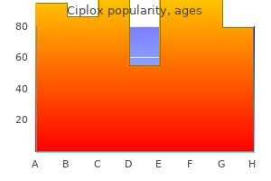 order ciplox now