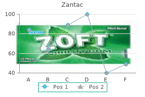 cheap 150mg zantac mastercard